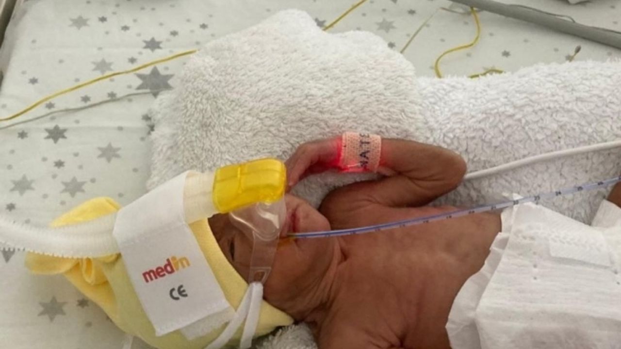 850 gramlık Birsen Asel bebek, 100 günde yaşama tutundu